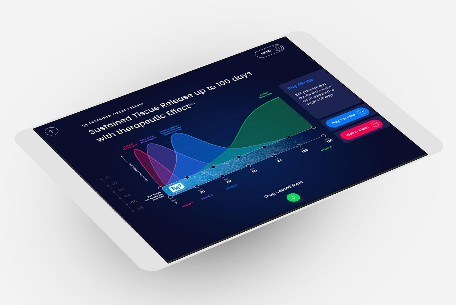 New Stent Product Launch for Biosensors International