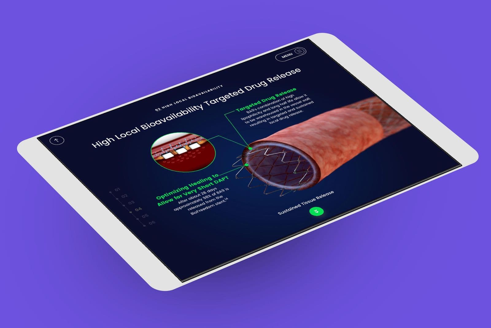 New Stent Product Launch: Promoting the clinical benefits of new drug-eluting stent