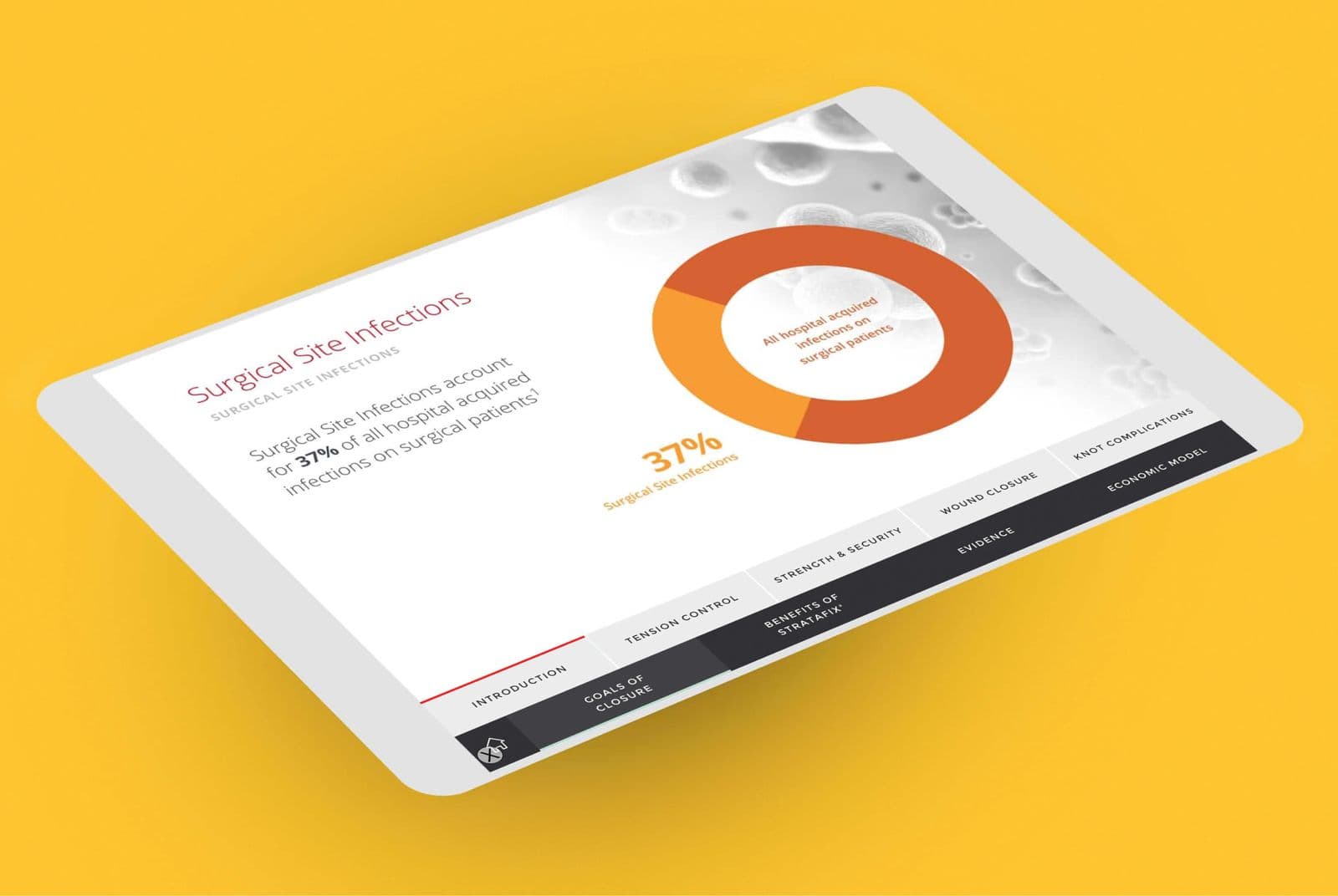 Healthcare Economics Calculator: Demonstrating the economics of advanced sutures