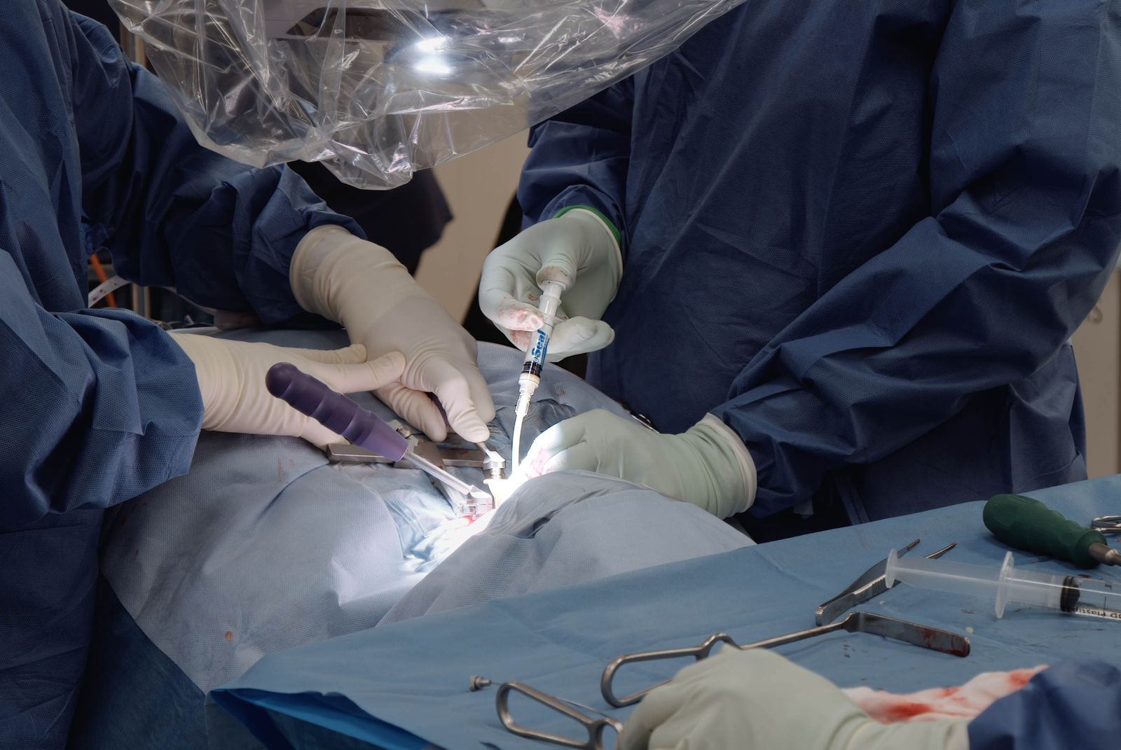 Advanced Surgery: Supporting adoption of advanced haemostats and sealants